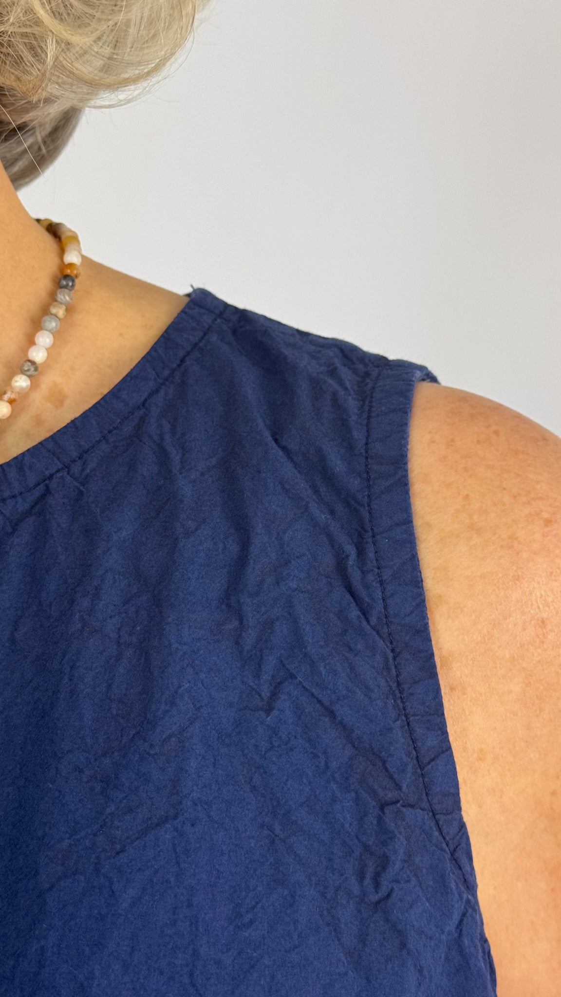 Privatsachen Hautnack Top Raum
